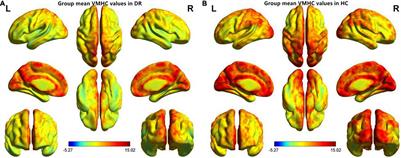 Aberrant Interhemispheric Functional Connectivity in Diabetic Retinopathy Patients